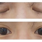 [댓글부탁해] 나 <b>쌍수</b> 어땡