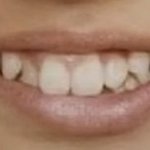 [댓글부탁해] 얘들아 이정도면 <b>치아</b>교정 해야할 것 같아?