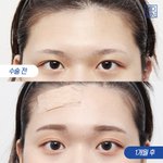 와 이마<b>거상</b> 개땡긴다