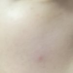 [드루와] 여드름 절대 안 나는 방법은 알고 <b>판함</b>?