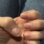 네일제거 받고 사람손톱이 아니에요 도와주세요!