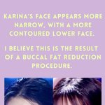 에스파 카리나는 새로운 턱 <b>면도</b>와 코 수술을 받았습니까?