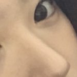 [드루와] 코 성형 <b>티나</b>?