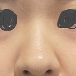 나 코 많이 못생김??