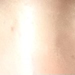 나 다크<b>써클</b> 개지림
