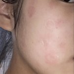 [드루와] 깐달걀 피부 꿀팁 다 푼다 ㄹㅇ 인증