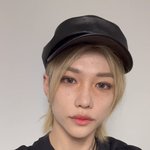 와 <b>용복</b>이 주근깨 대박 이쁨