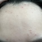 약혐?주의) 내 피부 이거 실화냐...