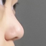 이런 코면 <b>수술</b>한다 안 한다?