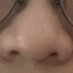 이런 <b>복코</b>는…(사진있음)