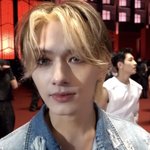 세븐틴 준 얼굴 <b>상태</b>