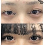 [댓글부탁해] 이런 <b>쌍꺼풀</b> 뭔 라인임?