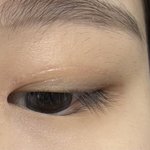 [댓글부탁해] 이거 쌍수 <b>앞쪽</b> 풀린거야..?