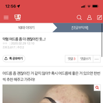 [19] 약 3년 걸린 여드름 <b>탈출</b> 쓰니인데