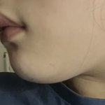 나는 무턱이 문제인거임 입툭튀가 문제인거임?