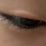 이거 <b>쌍액</b> 부작용인가..