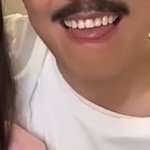 와 여단오 남자분 앞니 하나래