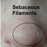 남의 얼굴 볼 <b>때</b> <b>코</b>에 블랙헤드까지 보냐?