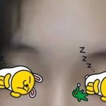 [댓글부탁해] <b>코</b> 수술ㅠ