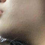 나 입툭튀에 <b>무턱</b> ㄹㅈㄷ