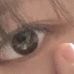 이거 꼬막눈이야?