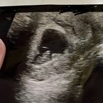 [꼭좀봐줘] 낙태수술날인데 고기썰어야된다고,,, 낙태수술보다 가게가...