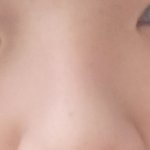 나ㅇ복코 심하지?ㅜㅜ