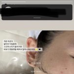 와 <b>피부</b> 이거 어케 하는 거임?