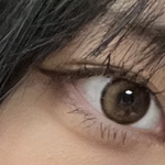 다크서클 팔자<b>주름</b> 어덕함 ㄹㅇ