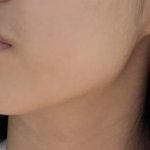 여드름주의) 10키로 <b>턱</b><b>선</b> 차이 보여줌