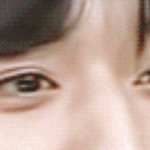 이런 <b>눈</b> <b>성형</b>으로 가능???ㅜㅜㅜ
