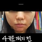 [드루와] 4키로 쪘는데 <b>코에</b> 살 찐거같음