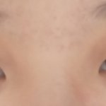 [꼭조언부탁] 이런 복코 <b>쉐딩</b> 어뜨케..