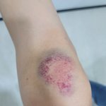 [드루와] 다친사진있) 이거 폭행죄로 고소할 수 있음?
