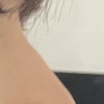 나 <b>매부리</b> 심함?