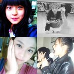 [댓글부탁해] 입술에 모기 <b>물림</b>