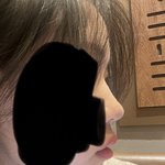 [댓글부탁해] <b>돌출</b>입 교정 끝나면 얼마나 달라져??