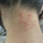 나 피부에 이상한 거 올라왓어ㅠ