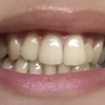 [드루와] +)나 <b>이빨</b> 엄청 하얘지지 않았냐