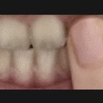 나 이빨 <b>개작음</b>