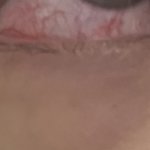 [혐쥬의] 나 눈 <b>충혈</b> 왜이럼?