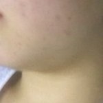 이거 이<b>중턱</b>이야??