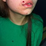 제 <b>딸</b>이 폭행을 당했습니다