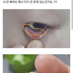 [댓글부탁해] 아까 속눈썹 쓰닌데 (+<b>사진o</b>, 약혐일수더)