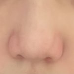 <b>복코</b> 개빡친다