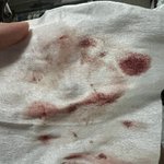 [댓글부탁해] 입술 뜯는 <b>버릇</b>