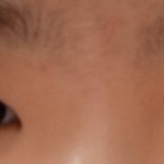 [댓글부탁해] <b>빛삭</b> 나 쌍수 성공할 것 같음..?