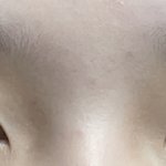 나 쌍수하면 잘될거같냐