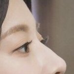 고윤정 코수술?