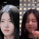 <b>베몬</b> 로라 코 수술 햇나봐